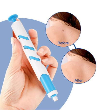 Kit Removedor de Verrugas Sin Dolor