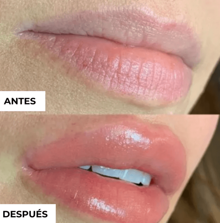 Labios más llenos e irresistibles en minutos Magic Lip®