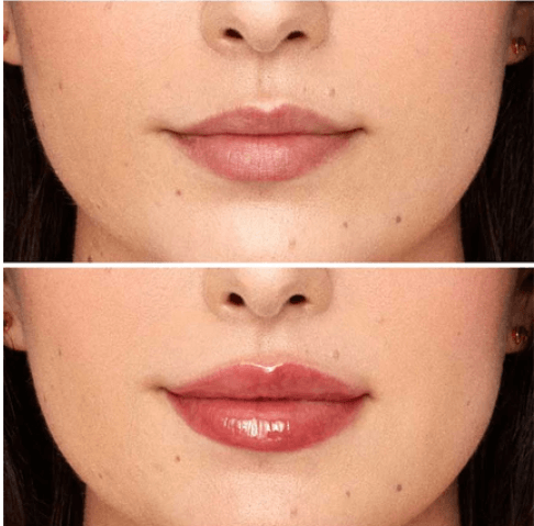 Labios más llenos e irresistibles en minutos Magic Lip®