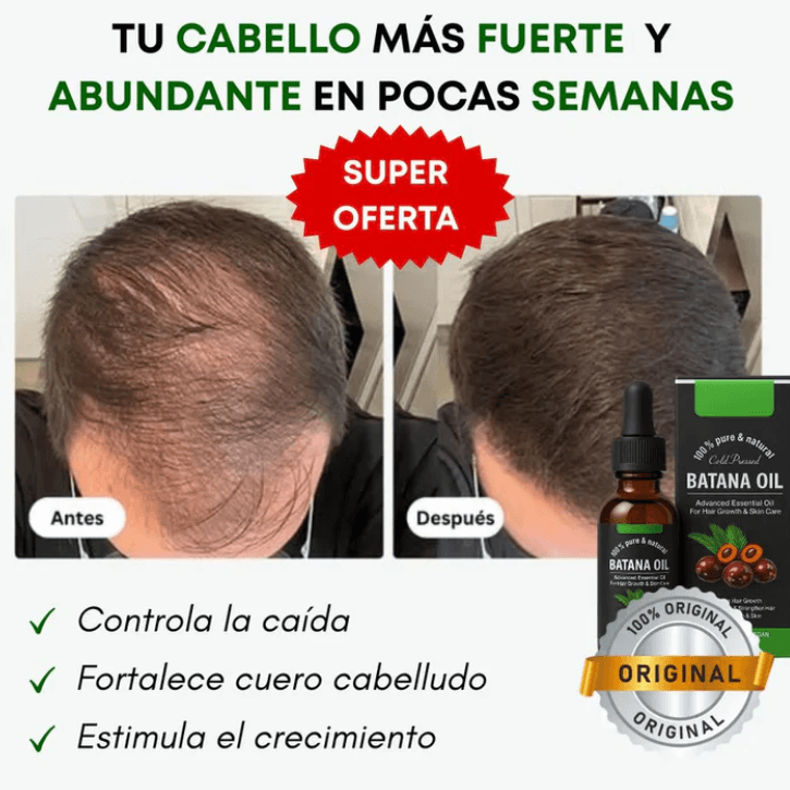 SHAMPO DE BATANA PREMIUM "obsequio aceite de batana"