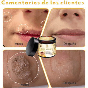 Bee Venom–Crema Reparadora y Rejuvenecedora 2 x 1